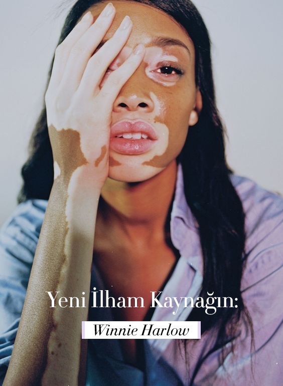Yeni İlham Kaynağın; Winnie Harlow